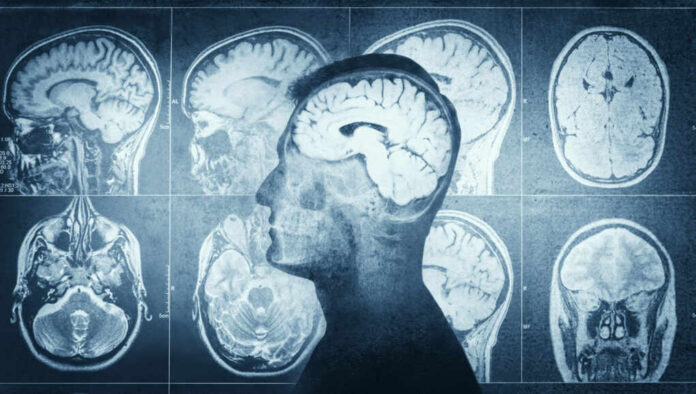 shutterstock_1942537936.jpg MRI scans of the brain displayed alongside a silhouette of a human head