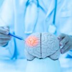 Doctor examining a model of a brain with a pen