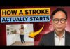 What a Stroke Looks Like the Day Before It Hits — Know This to Protect Yourself