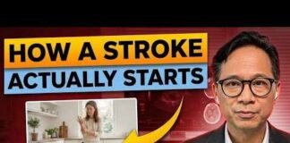 What a Stroke Looks Like the Day Before It Hits — Know This to Protect Yourself