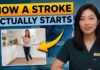 What a Stroke Looks Like the Day Before It Hits What a Stroke Looks Like the Day Before It Hits — Know This to Protect Yourself