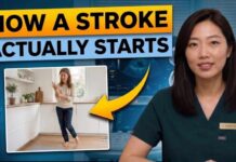 What a Stroke Looks Like the Day Before It Hits — Know This to Protect Yourself