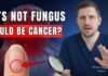 When to be concerned about ridges on your fingernails A Doctor's Warning: 7 Nail Signs That Reveal Hidden Disease (Don't Ignore These)