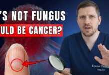 When to be concerned about ridges on your fingernails A Doctor's Warning: 7 Nail Signs That Reveal Hidden Disease (Don't Ignore These)