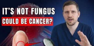 A Doctor's Warning: 7 Nail Signs That Reveal Hidden Disease (Don't Ignore These)