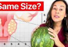 Fibroid Size Explained (When You Should Actually Worry)