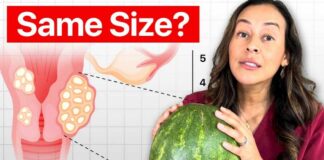 Fibroid Size Explained (When You Should Actually Worry)