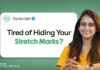 How to Get Rid of Stretch Marks & Cellulite Reclaim Your Confidence: Advanced Solutions for Stretch ...