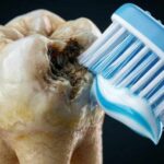 Why Your Teeth Decay Even If You Brush