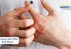 Popular Eczema Remedy May Fall Short