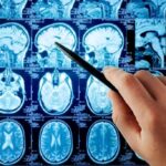 Hand pointing at brain MRI scans with a pen