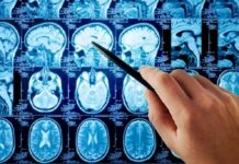 Epigenetics – How Your Mind Can Reprogram Your Genes | Harvard Study Hand pointing at brain MRI scans with a pen