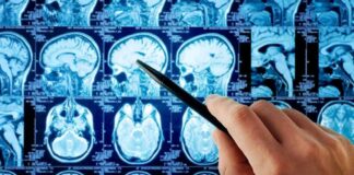 Hand pointing at brain MRI scans with a pen