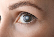 $20 Eye Cream Saver For Zombie Eyes Close-up view of a human eye showcasing the iris and eyelashes