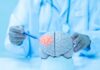Chronic Migraine’s Brutal Funnel Exposed Doctor examining a model of a brain with a pen