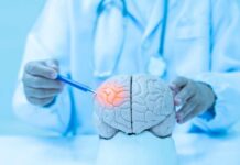 Chronic Migraine’s Brutal Funnel Exposed Doctor examining a model of a brain with a pen
