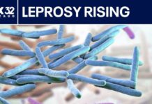 Leprosy cases increase in the US: Here's what to know