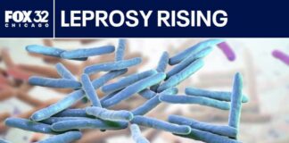 Leprosy cases increase in the US: Here's what to know