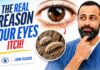 Your Itchy Eyes Might NOT Be Allergies… It Could Be Your Eyelids