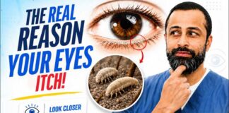 Your Itchy Eyes Might NOT Be Allergies… It Could Be Your Eyelids