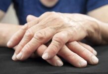 Wrinkle Panic? The best way to prevent wrinkles Elderly hands resting and crossed on a dark surface