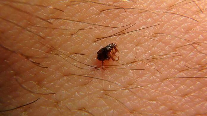 Flea on human skin