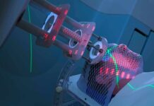 AI Flags First Imaging Biomarker of Chronic Stress Patient undergoing head radiotherapy with laser alignment and immobilization mask