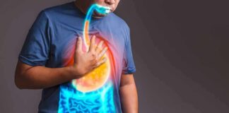 Person clutching chest with illustrated reflux and stomach overlay
