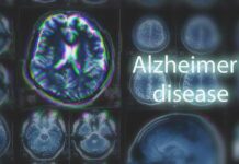 Surprise Alzheimer’s Signal in PCOS Women Brain MRI scans with highlighted section and text overlay