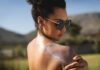 Morning Sun: Burn-Free Doesn’t Mean Safe Woman in sunglasses applying sunscreen to her shoulder outdoors